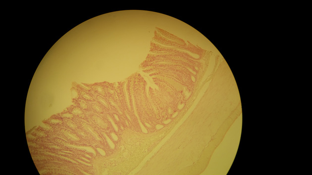 Colon Slides - Colon 001 100X